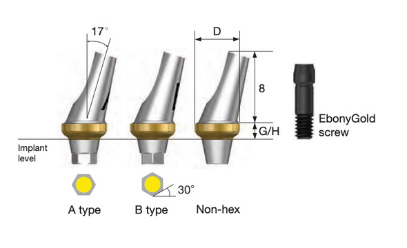 Angled Abutment
