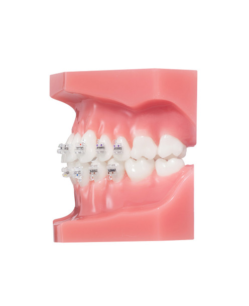 OK Real Resin MBT 018