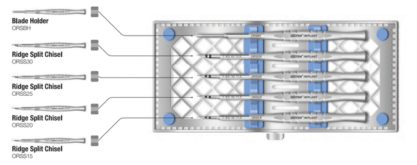 Ridge Split KIT