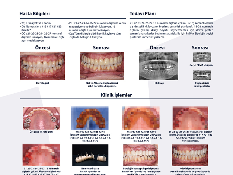 Implant Üstü Protez - Dr. Tolga Kodaz