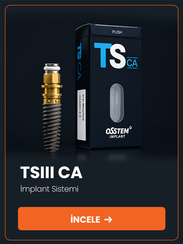 TSIII CA