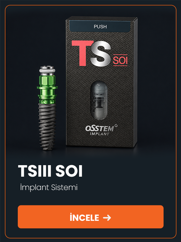 TSIII SOI