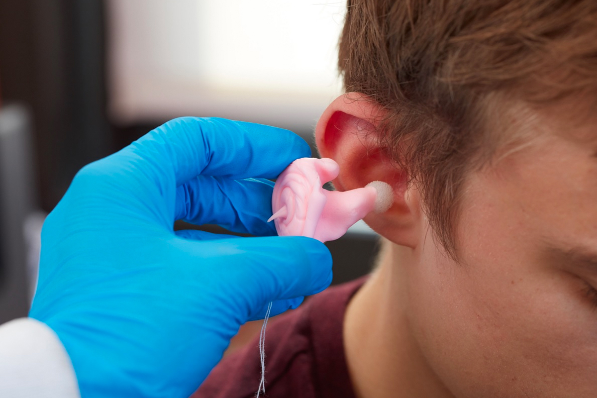 Custom Ear Mould Impressions