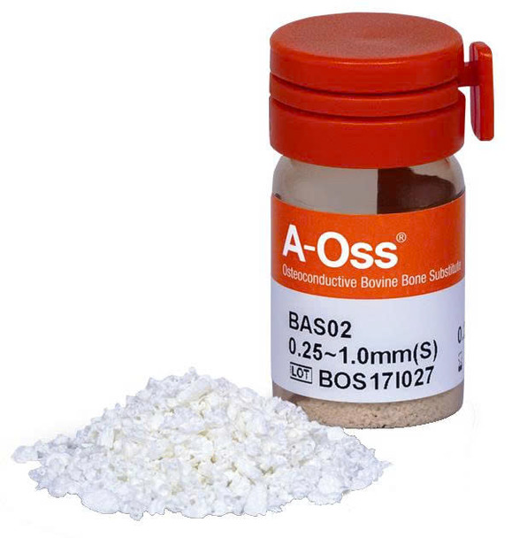 Xương dị chủng A-Oss