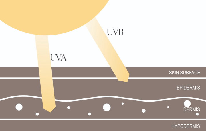 Infographic of UVA and UVB rays penetrating skin layers—epidermis, dermis, and hypodermis—highlighting sun protection needs