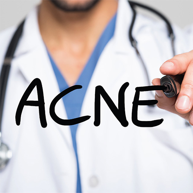 Acne 101: How Does Acne Form?
