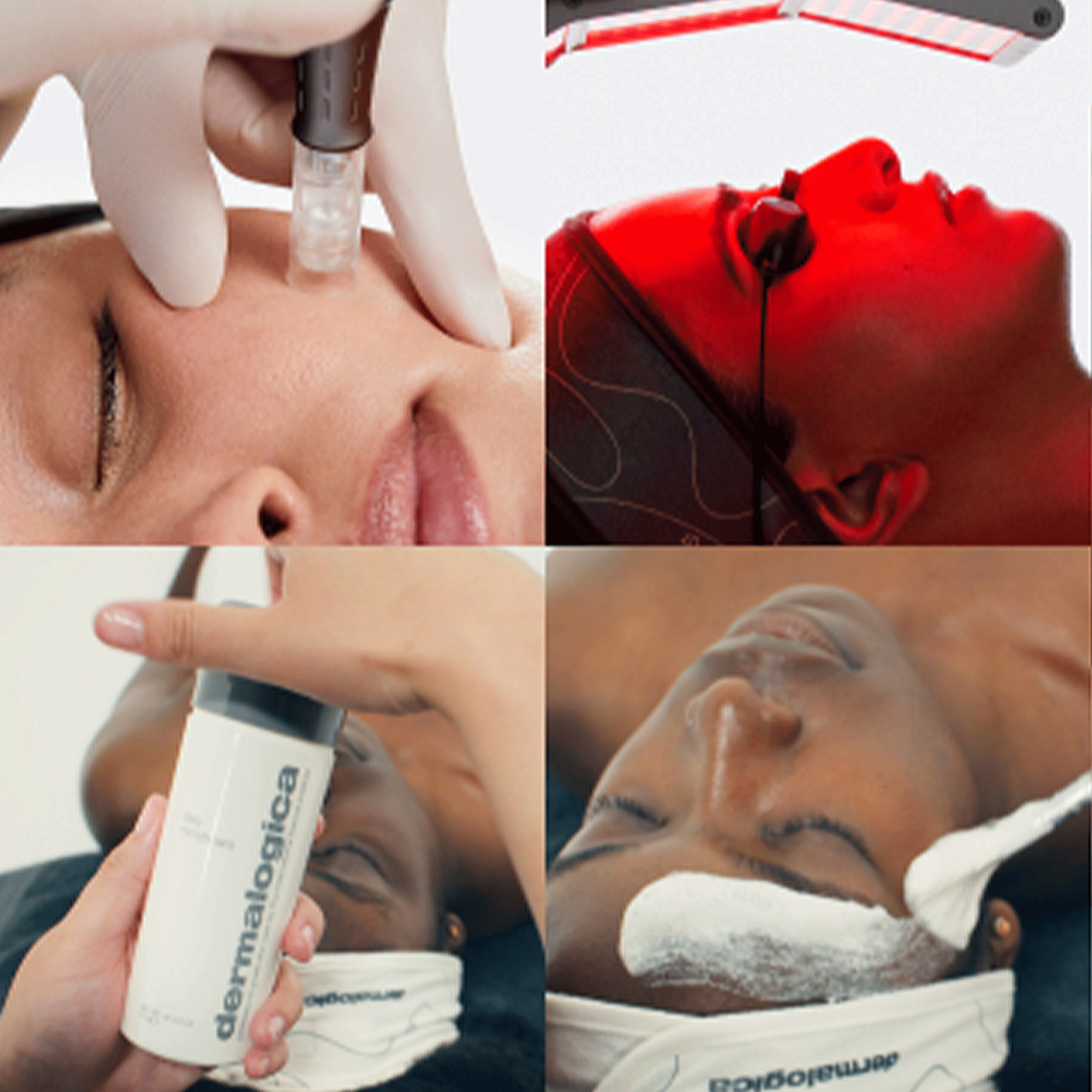 Dermalogica
