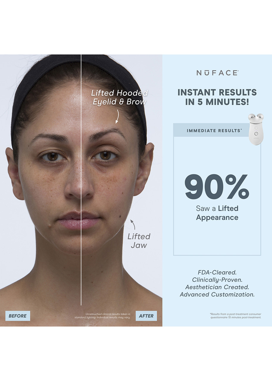  Nuface Trinity+ Complete Set - Features A Led Red Light Wrinkle Reducer 