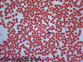 Prepared Slide, Human Blood, pkg. 6