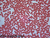 Prepared Slide, Human Blood, pkg. 6