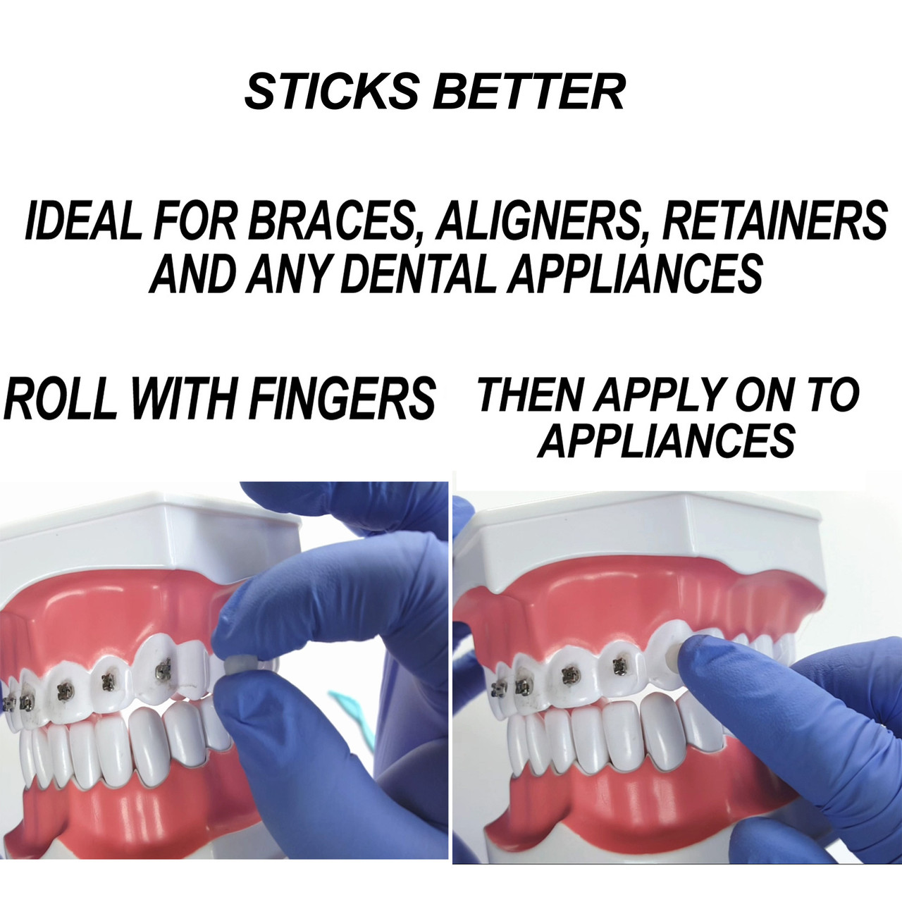 Monoblock Braces With Hook on #3 - ORTHOMECHANIC LC