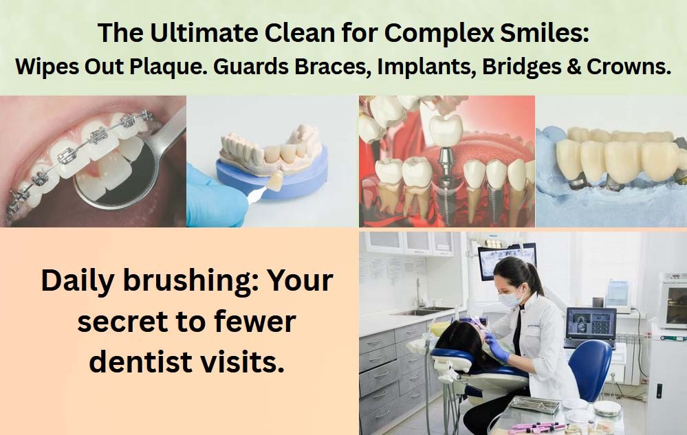 Diagram showing what interdental brushes are for