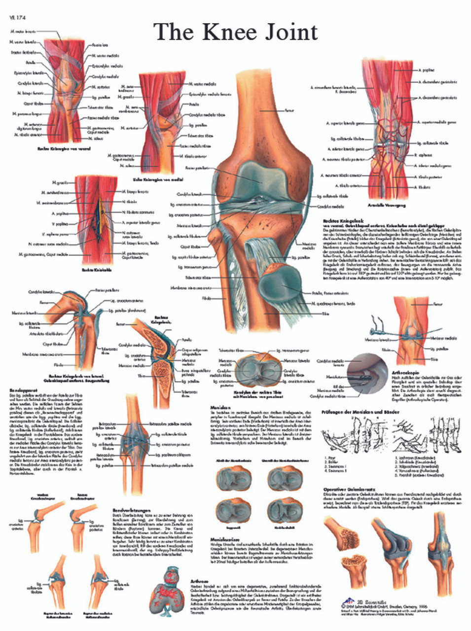 Anatomical Chart - knee joint, sticky back