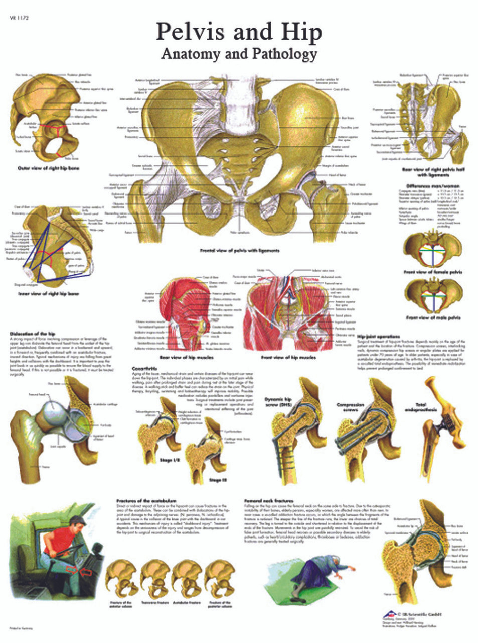Anatomical Chart - hip & pelvis, laminated