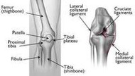 Tibial Plateau Fracture (TPF) sufferers, we have news for you!