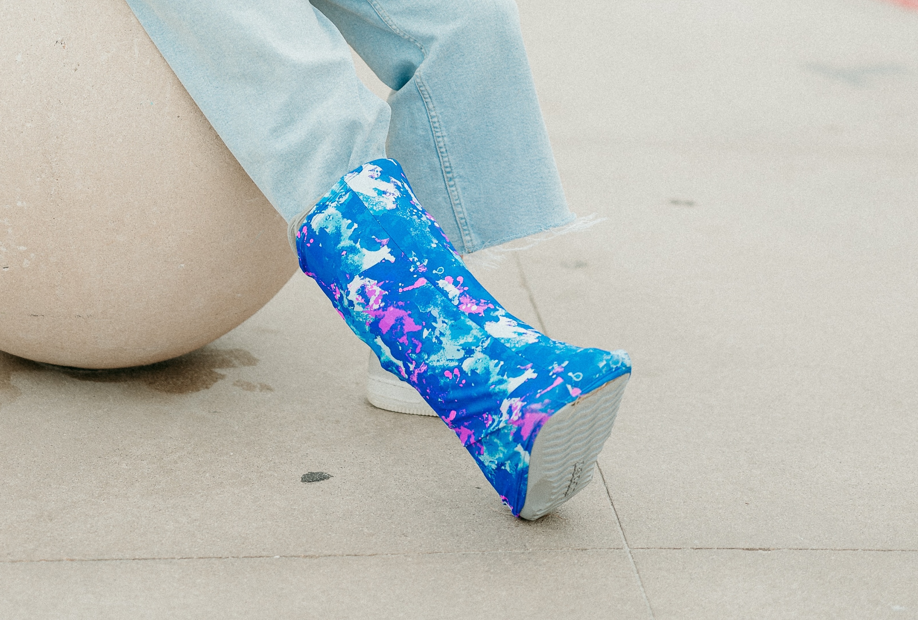 Person wearing a colorful tie-dye walking boot cover during orthopedic recovery