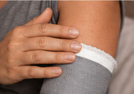 Comfort & Irritation: Person adjusting the edge of a leg cast to relieve rubbing and skin irritation