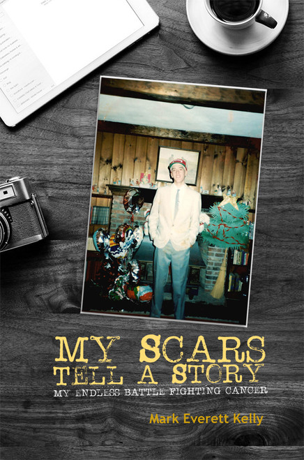 My Scars Tell a Story - eBook
