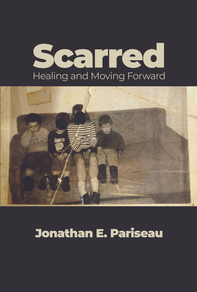 Scarred: Healing and Moving Forward - eBook