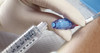 BD MaxPlus Connector, Needle-Free, Low Pressure, 10 ml/sec, 100/cs (Continental US Only)