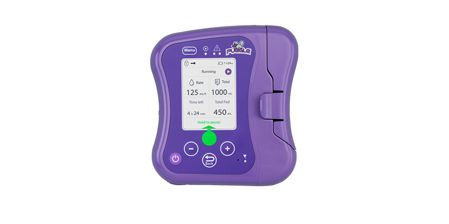 AMSINO PUGGLE™ ENTERAL FEEDING PUMPPuggle Enteral Feeding Pump, Includes: Pump, AC Adapter and Pole Clamp, 1/cs