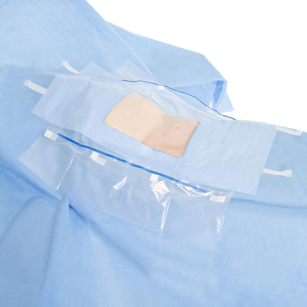HALYARD DRAPES - Laparoscopic/ Cholecystectomy Drape, 102" x 76" x 120", Non-Sterile, Bulk, 13/cs (US Only)
