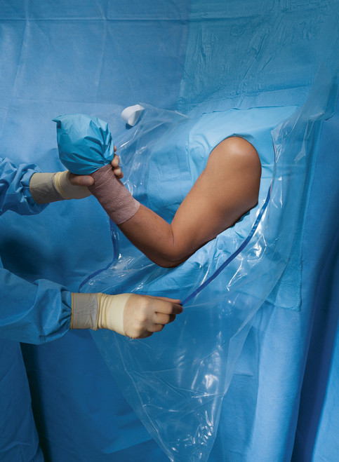 HALYARD DRAPES - Beach Chair Shoulder Arthroscopy Drape II, Sterile, 10/cs (US Only)