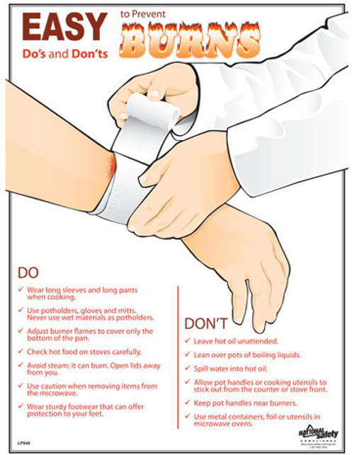 Prevent Burns Posters in ENGLISH  pic 1