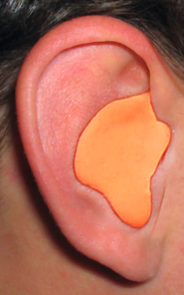 Radians Custom Molded Earplugs, Orange Color