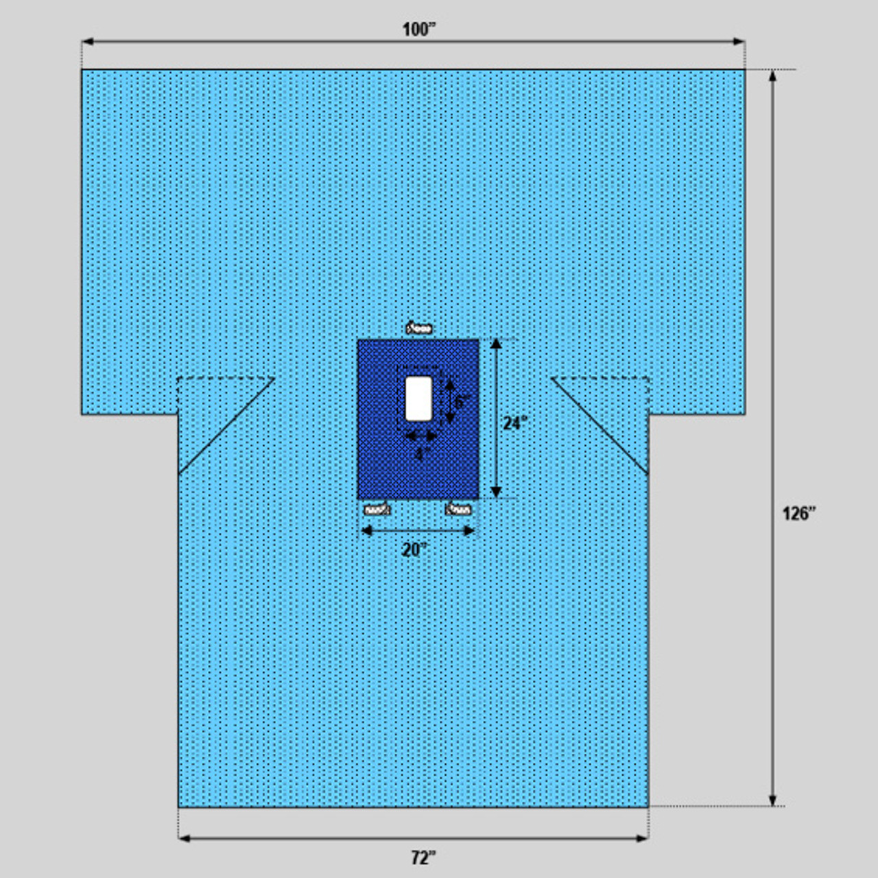 Pediatric Laparotomy T Drape, 100" x 72" x 126"