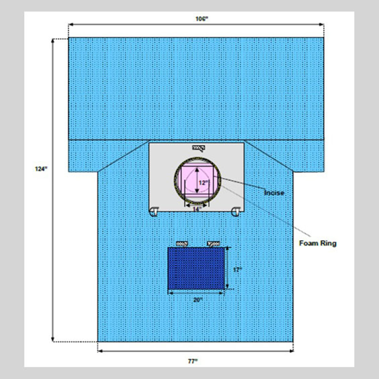 C-Section Drape with Pouch and Fenestration, Sterile