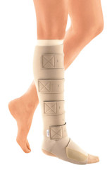 Compression Garments Fitting & Treatment of Lymphedema. Edema