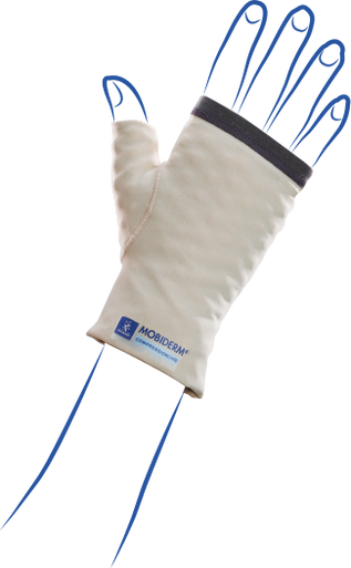 Lymphedema Moderate Compression Gauntlet - Thuasne