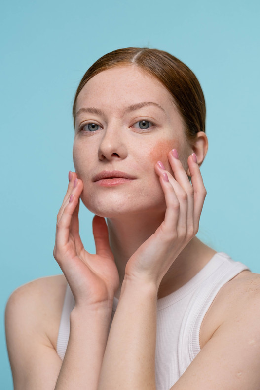 How Healthy Is Your Skin? Consider These Factors To Find Out