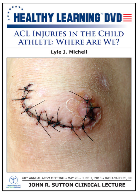 ACL Injuries in the Child Athlete: Where Are We?