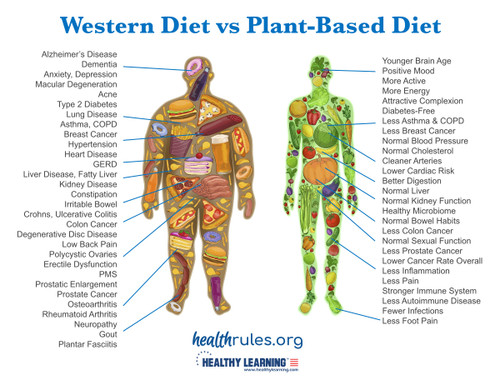 Western Diet vs Plant-Based Diet - Poster