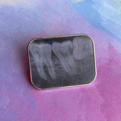Dental Size 2 Lenticular Pin