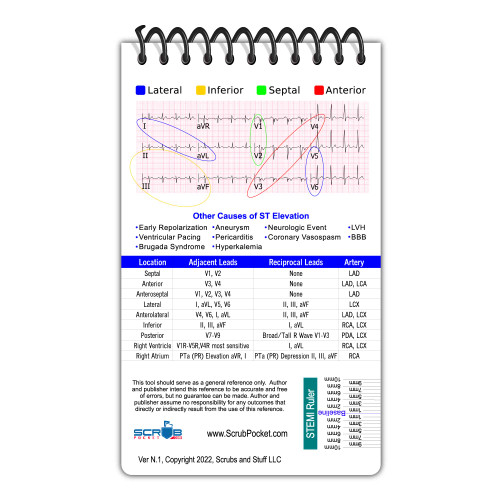 EKG 3x5" Notepad - Heavy Duty Reusable Covers