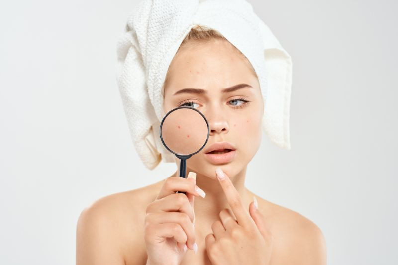 Why Your Haircare Products Could Be Causing Breakouts Why Your Haircare Products Could Be Causing Breakouts