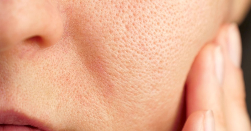 A Quick Guide to Shrinking Your Enlarged Pores A Quick Guide to Shrinking Your Enlarged Pores