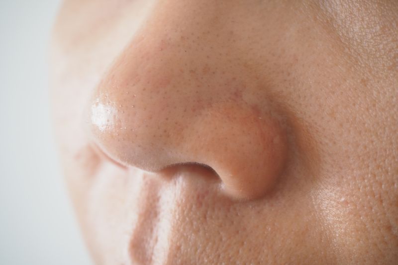 Why Your Nose Is Oily and How To Help Prevent It