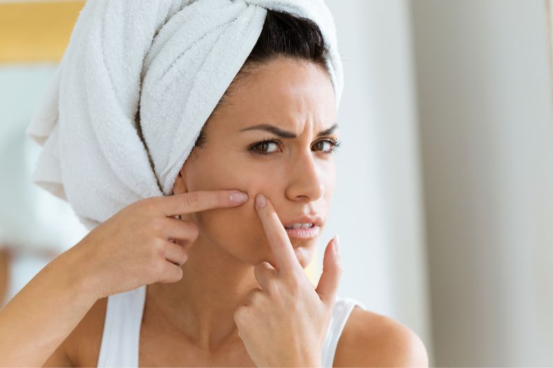 10 Dos and Don’ts To Get Rid of Pimples Fast