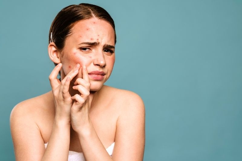 Don’t Pop Your Pimples: The Science Behind Pimple Popping