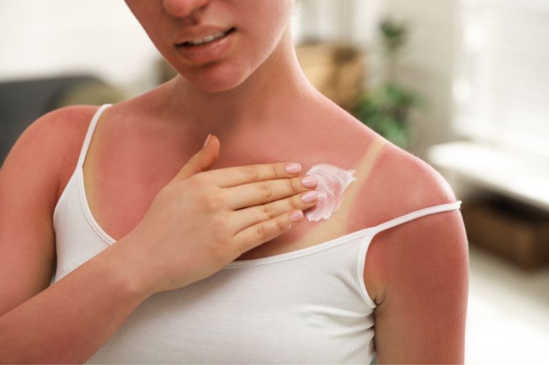 Common Summer Skin Problems and How To Prevent Them
