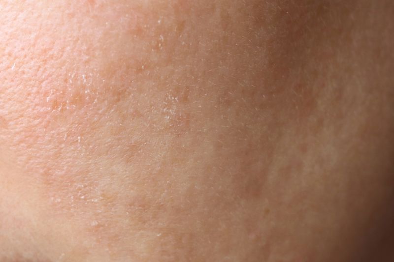 Avoid Dry Skin: Hydrating Foods To Help Lock Moisture
