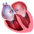 Heart with Atrial Septal Defect