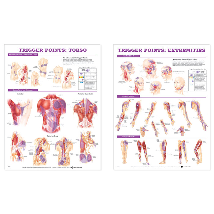 TRIGGER POINT CHART SET, LAMINATED