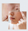 Anua Birch 70 Moisture Boosting Cream To Soothe Sensitive Skin 50ml showing benefits