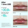 Anua PDRN Lip Serum