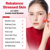 COSRX Azelaic Acid 20 B5 Redness Soothing Cream